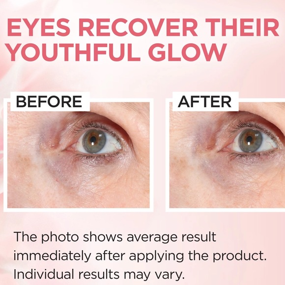 5/$20 L'Oreal Paris Age Perfect Rosy Tone, Anti-Aging Eye Brightener - Picture 3 of 5